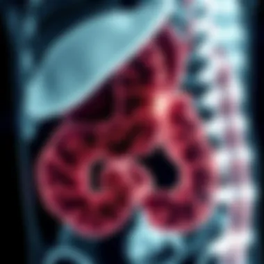 Diagnostic Imaging Approaches for Cecal Adenocarcinoma Diagnostic imaging techniques for cecal adenocarcinoma