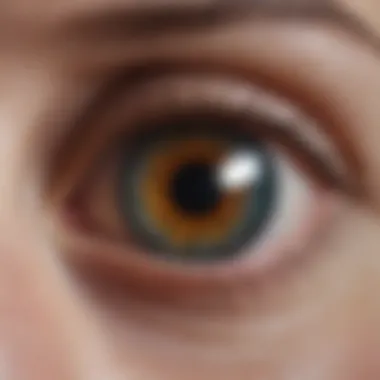 Symptoms of Ocular Graft Versus Host Disease Clinical manifestations of ocular GVHD