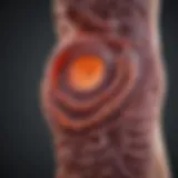 Detailed diagram of colon cancer pathology