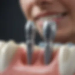 Illustration showing various types of dental implants