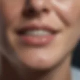 Illustration of enamel discoloration due to fluorosis