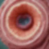 Illustration of the kidney structure affected by membranous glomerulonephritis