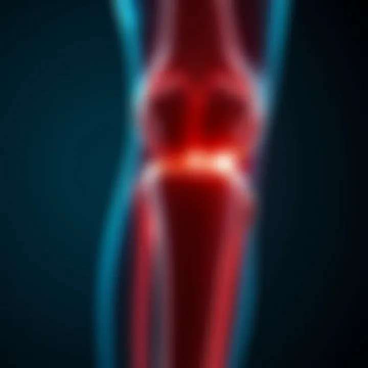 Osteophytes Formation on Knee Joints Illustration depicting osteophytes on knee joints