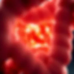 Detailed illustration of colon adenocarcinoma pathology
