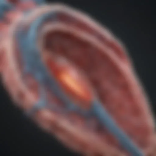 Diagram illustrating synergy stent complications