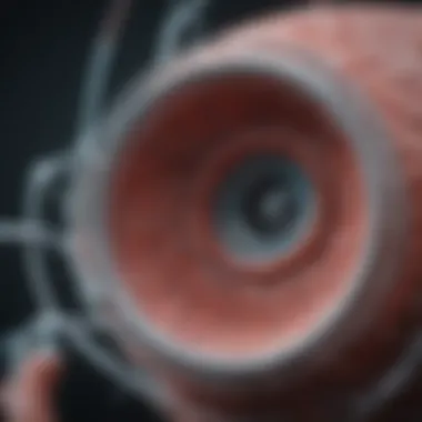 Illustration of the mechanisms behind synergy stent issues