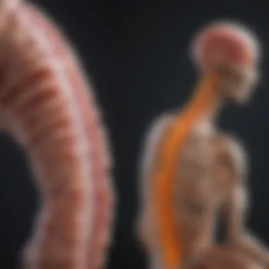 Categorizing Spinal Cord Injuries Diagram showing different types of spinal cord injuries