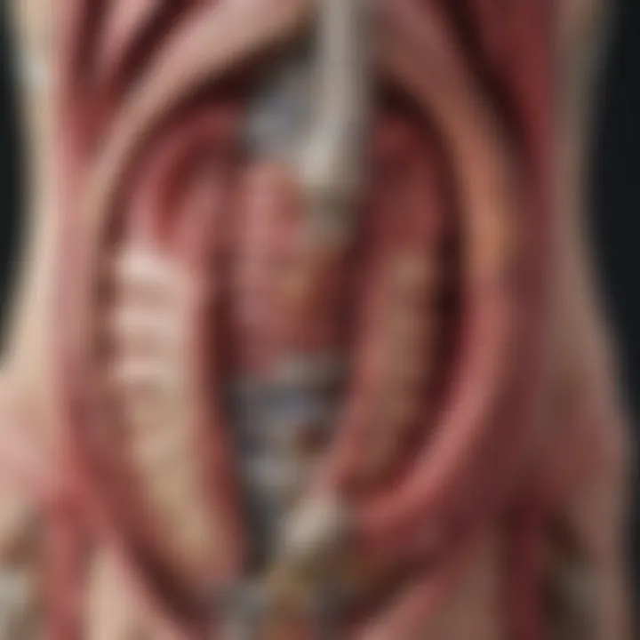 Anatomical illustration of the colon highlighting abnormal growth