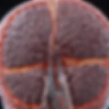 Neurological Insights into Cryptogenic Stroke Brain scan showing abnormalities linked to stroke