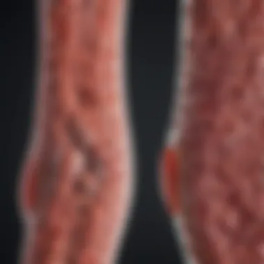 Benefits of Early Detection in Colon Cancer Visual representation of early detection's benefits in colon cancer