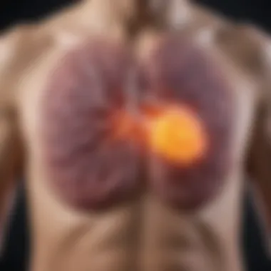 Stages of Metastatic Small Cell Lung Cancer Diagram illustrating the stages of metastatic small cell lung cancer