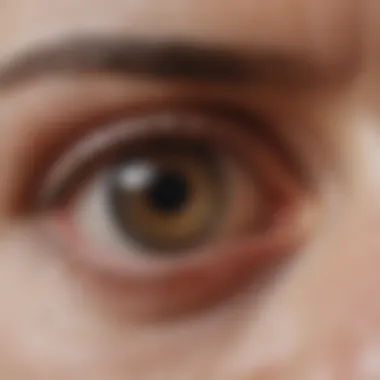 Neurological Pathways Impacting Eyelid Function Illustration depicting neurological pathways affecting eyelid function