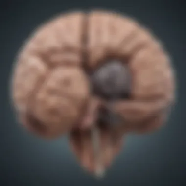 Illustration depicting the brain regions affected by Parkinson's disease.