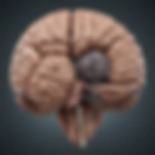 Illustration depicting the brain regions affected by Parkinson's disease.