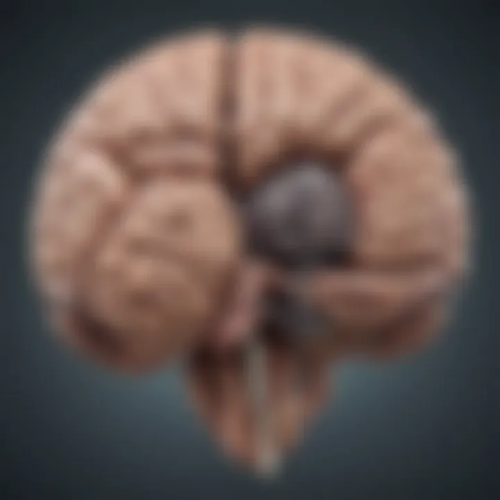 Illustration depicting the brain regions affected by Parkinson's disease.