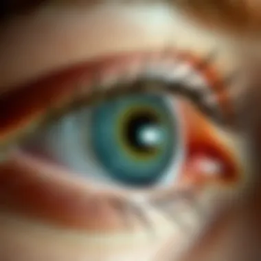 Close-up of an eye demonstrating dryness